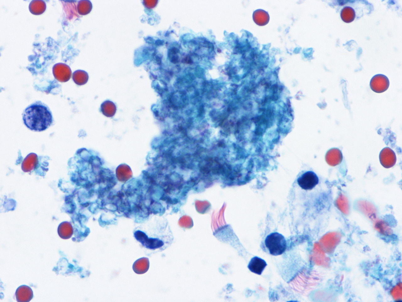 Pneumocystis jiroveci - Wikipedia